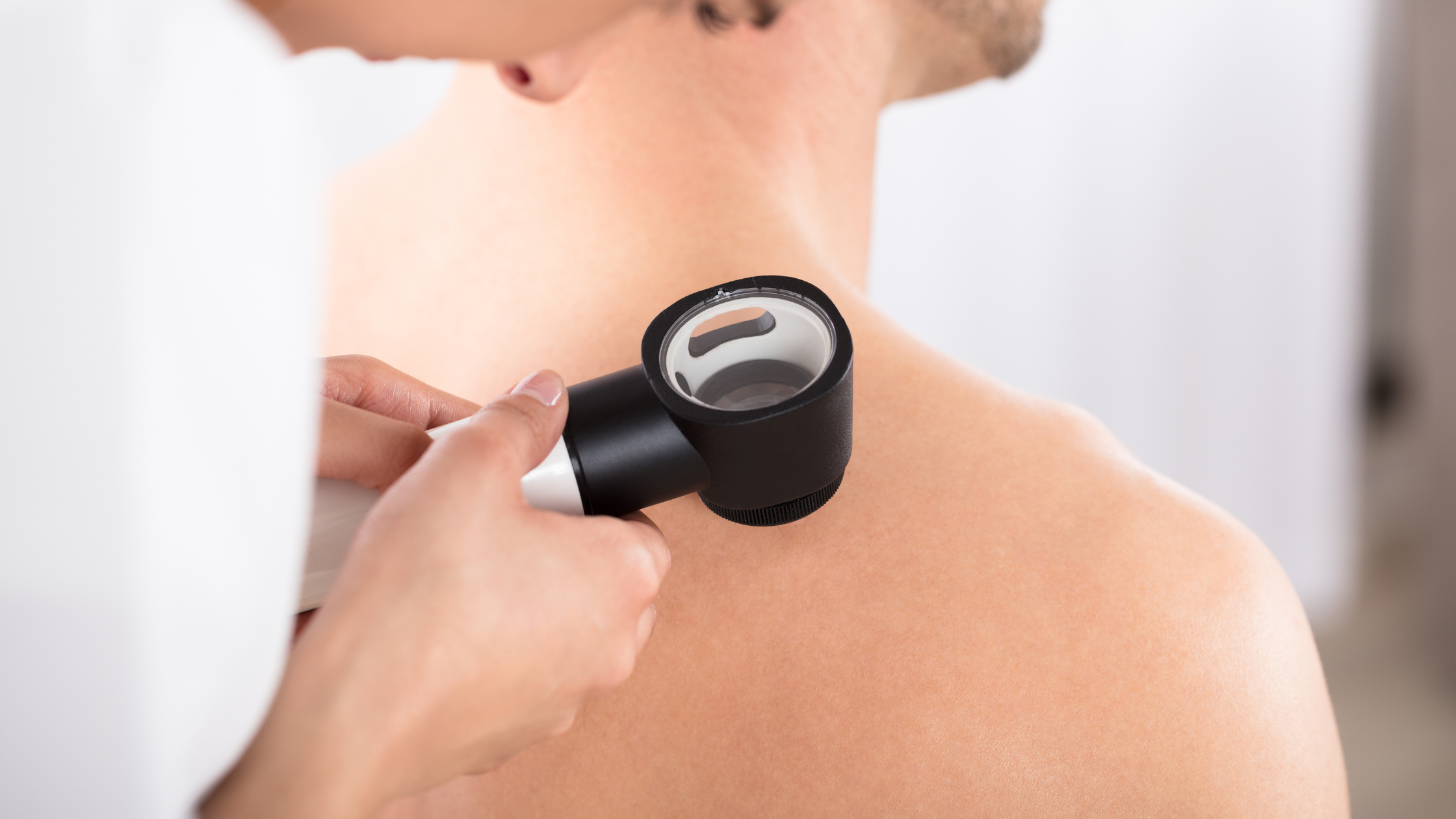 use the 'ABCDE Rule' to check for signs of Melanoma