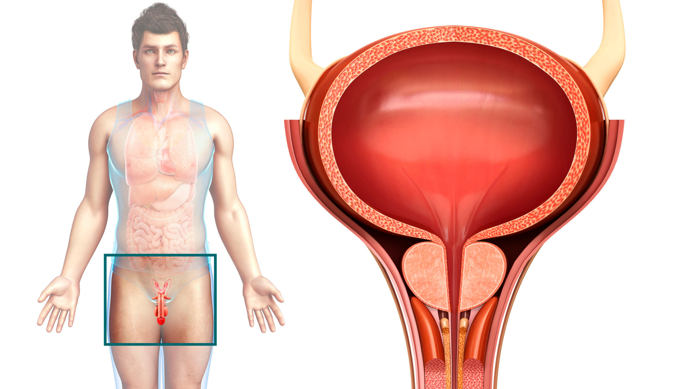 Illustration of male with a zoomed in illustration of bladder