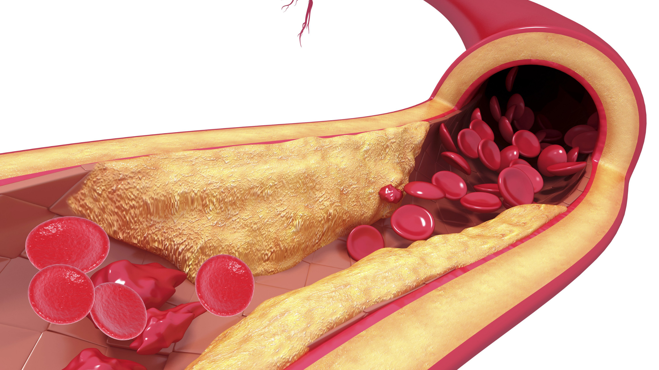 Illustration of the inside of a blood vessel, with red blood cells and cholesterol visible