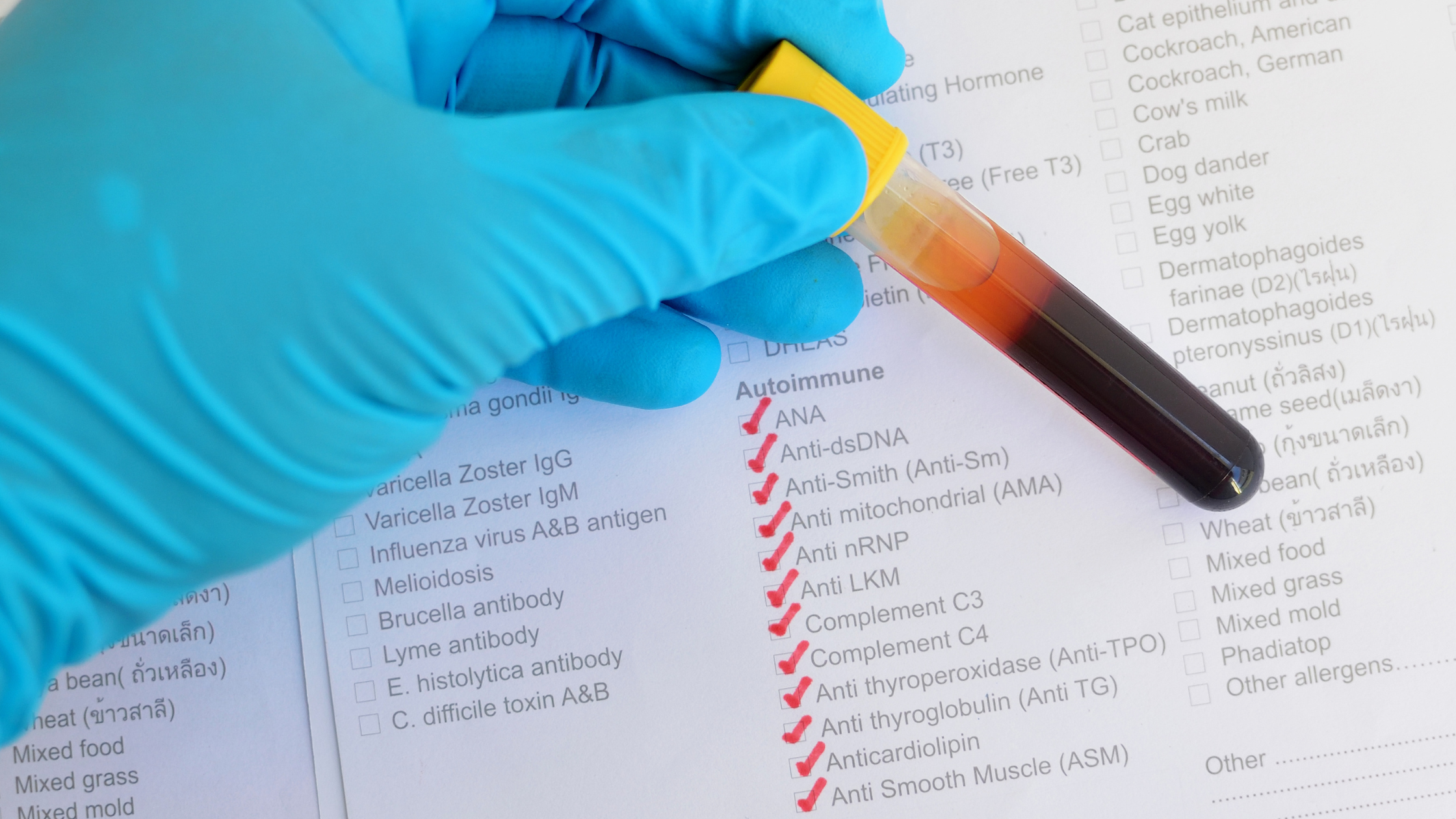 gloved hand holds a vial of blood over a checklist of medical conditions