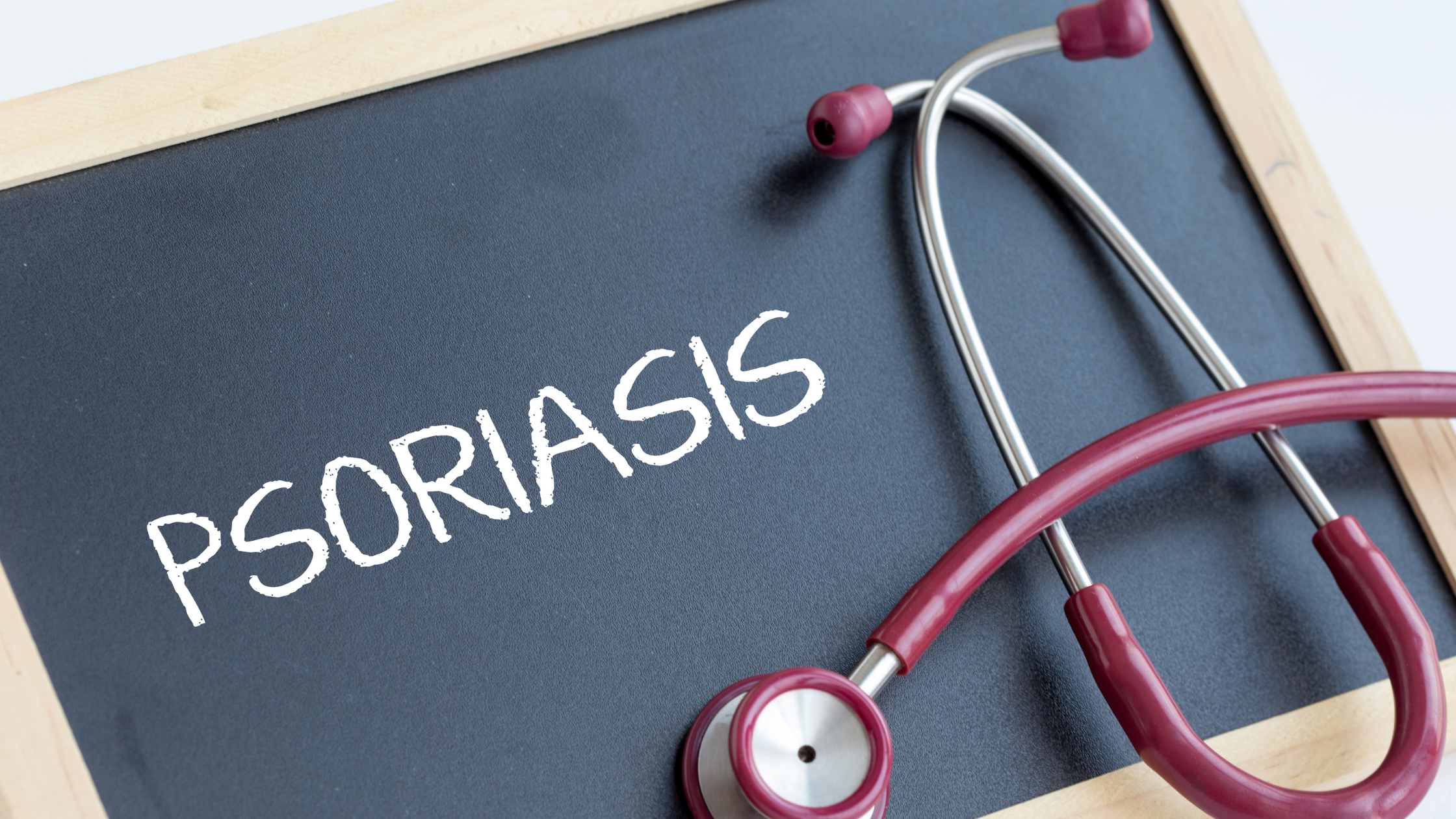 stethoscope laying on a blackboard that says 'psoriasis'