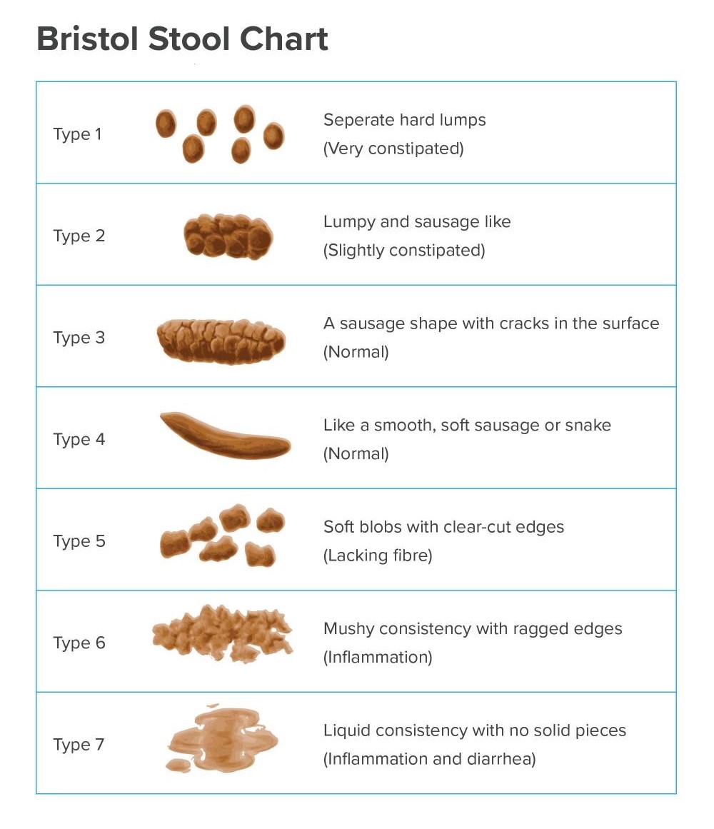Chart of 6 different types of Stool