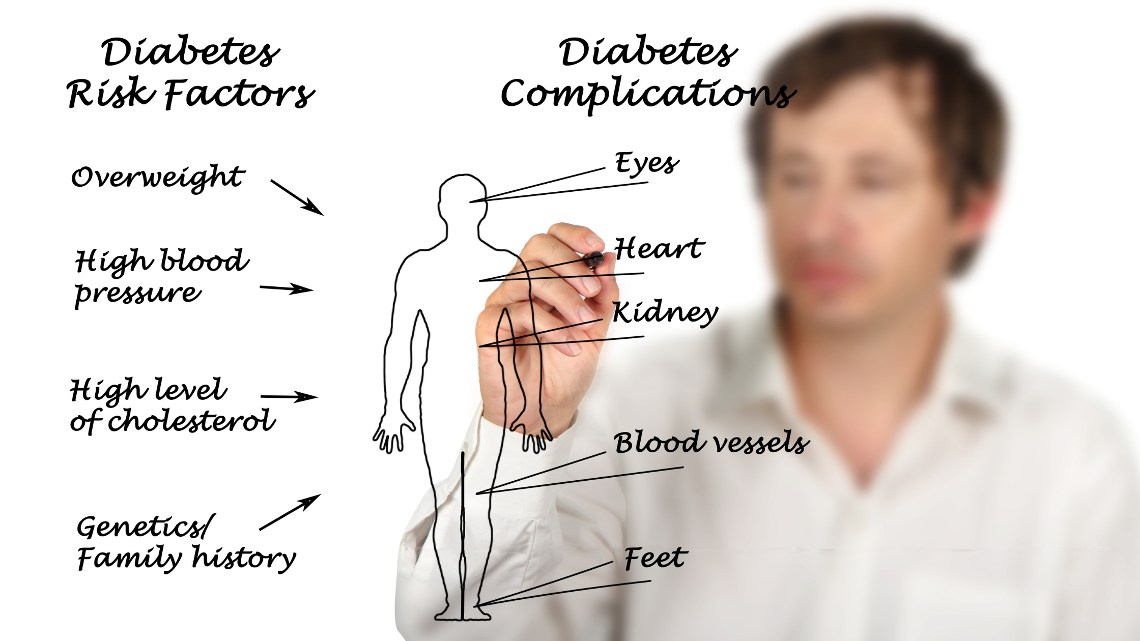 Man draws and writes out illustration describing diabetes risk factors on a clear plastic board 