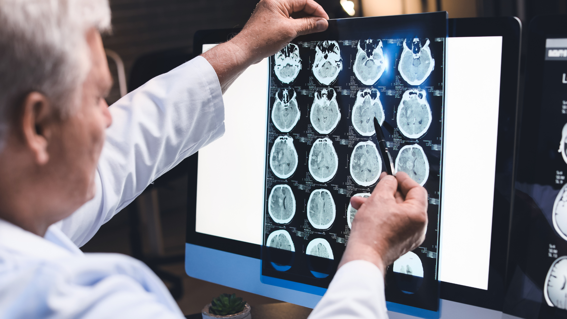 doctor examines a set of brain scans