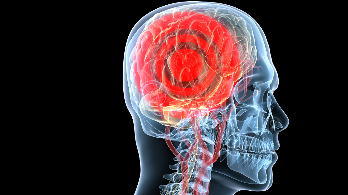 Transparent illustration of a person's head, brain visible with red target depicting pain