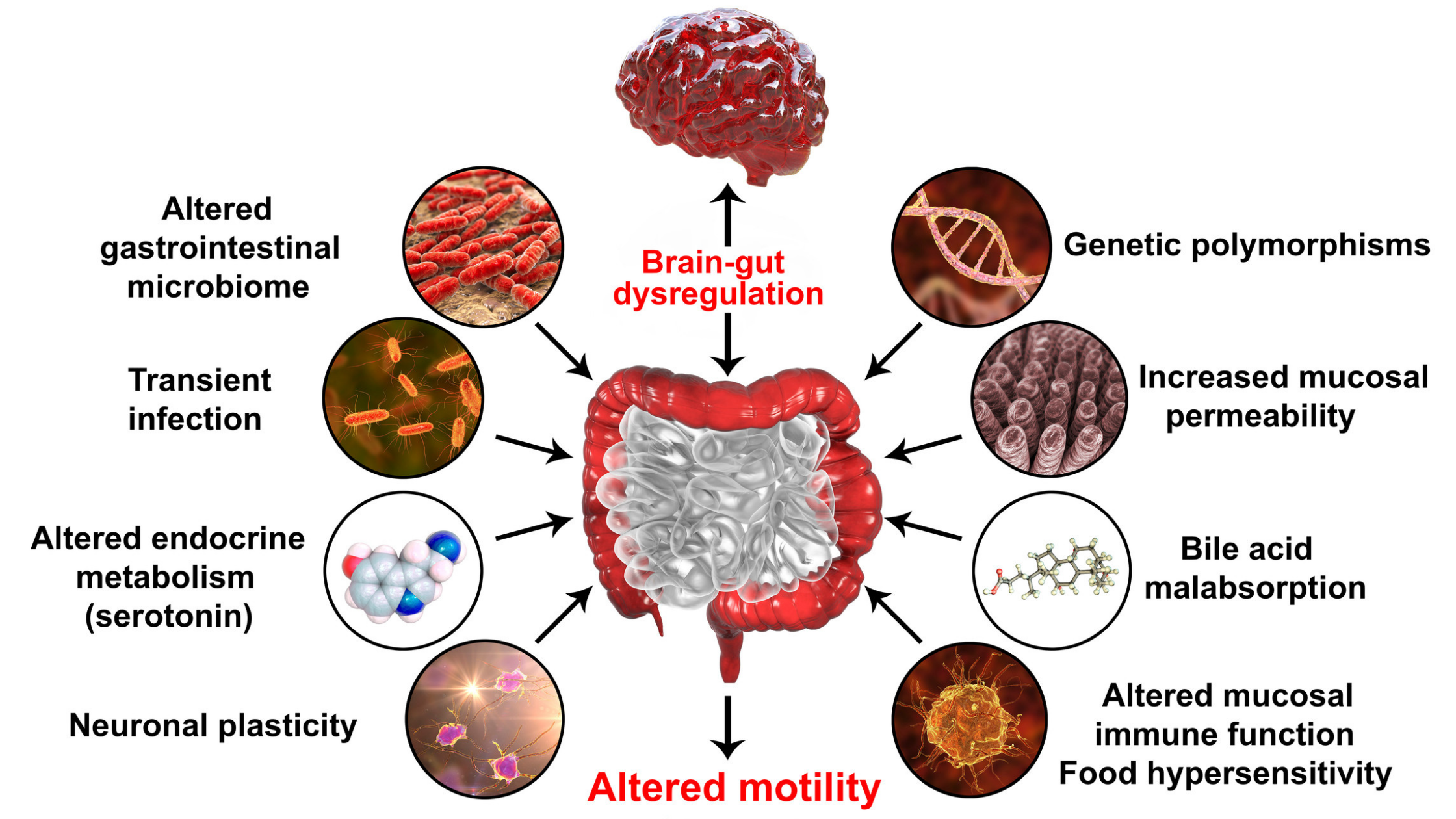 what foods trigger ibs attacks