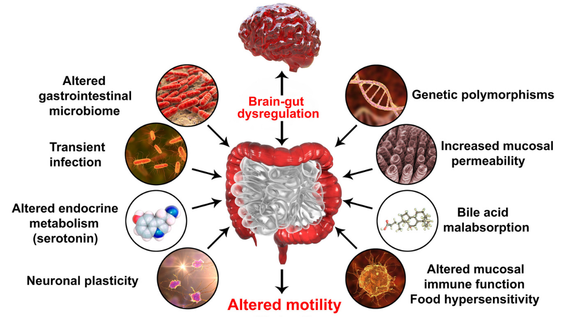 what causes ibs