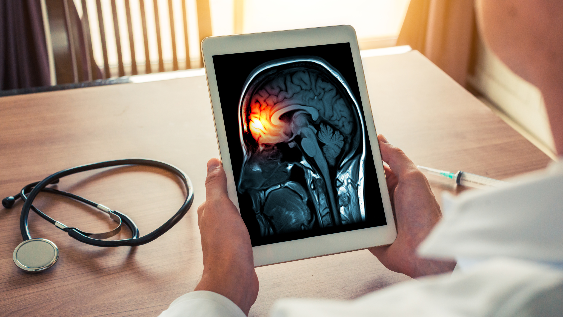 doctor holding a tablet with a scan of a human brain, clouded red in the front
