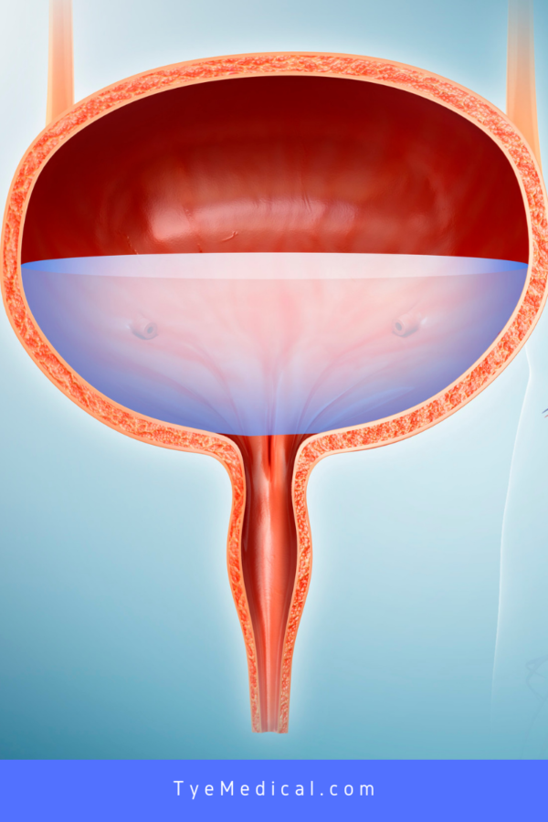 Illustration of a full bladder