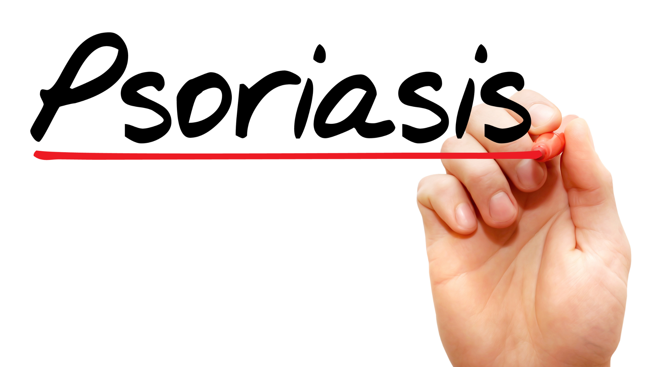 hand underlining the word 'psoriasis' in red