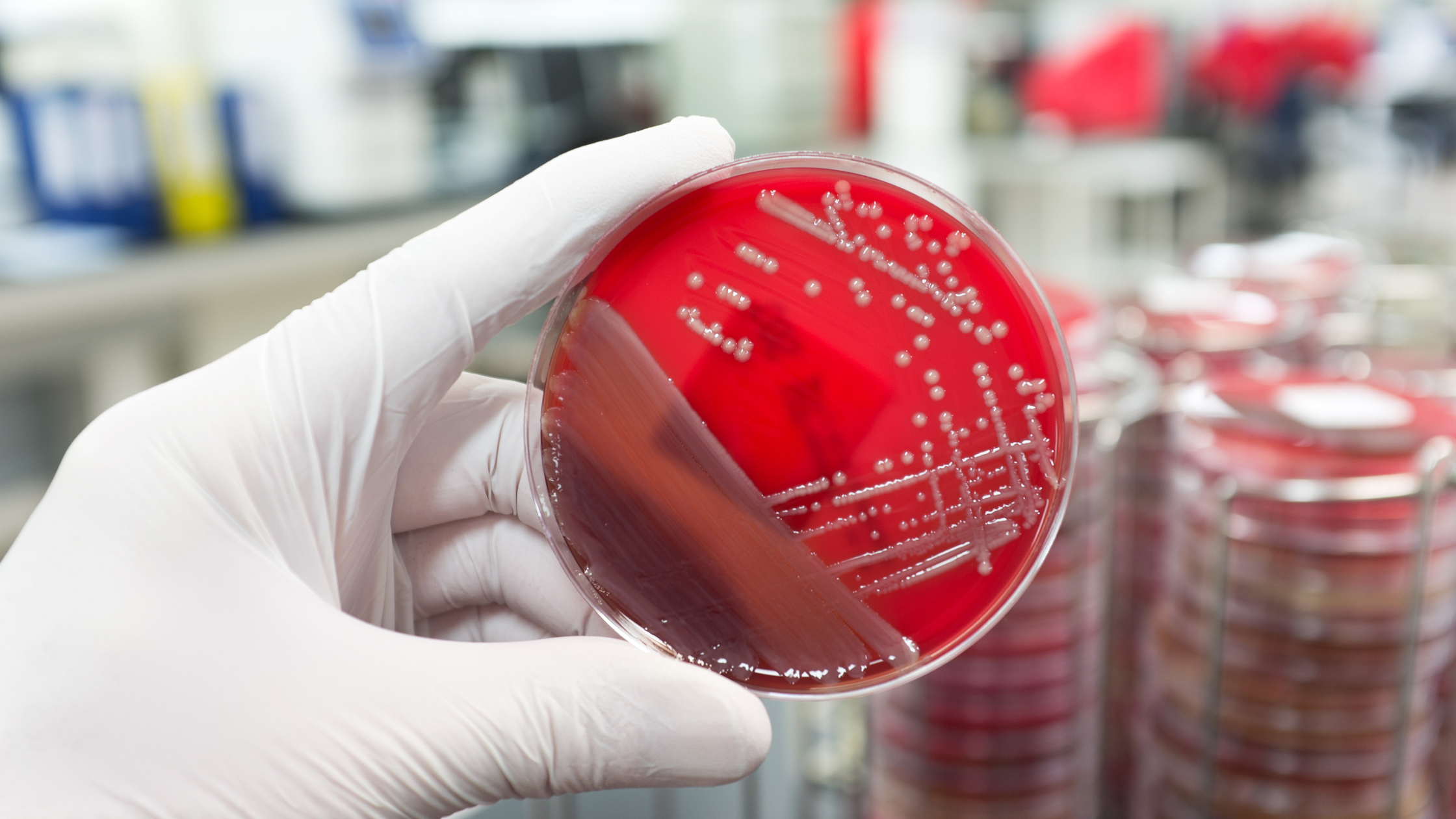 scientist holding a red petri dish with white bacteria growing