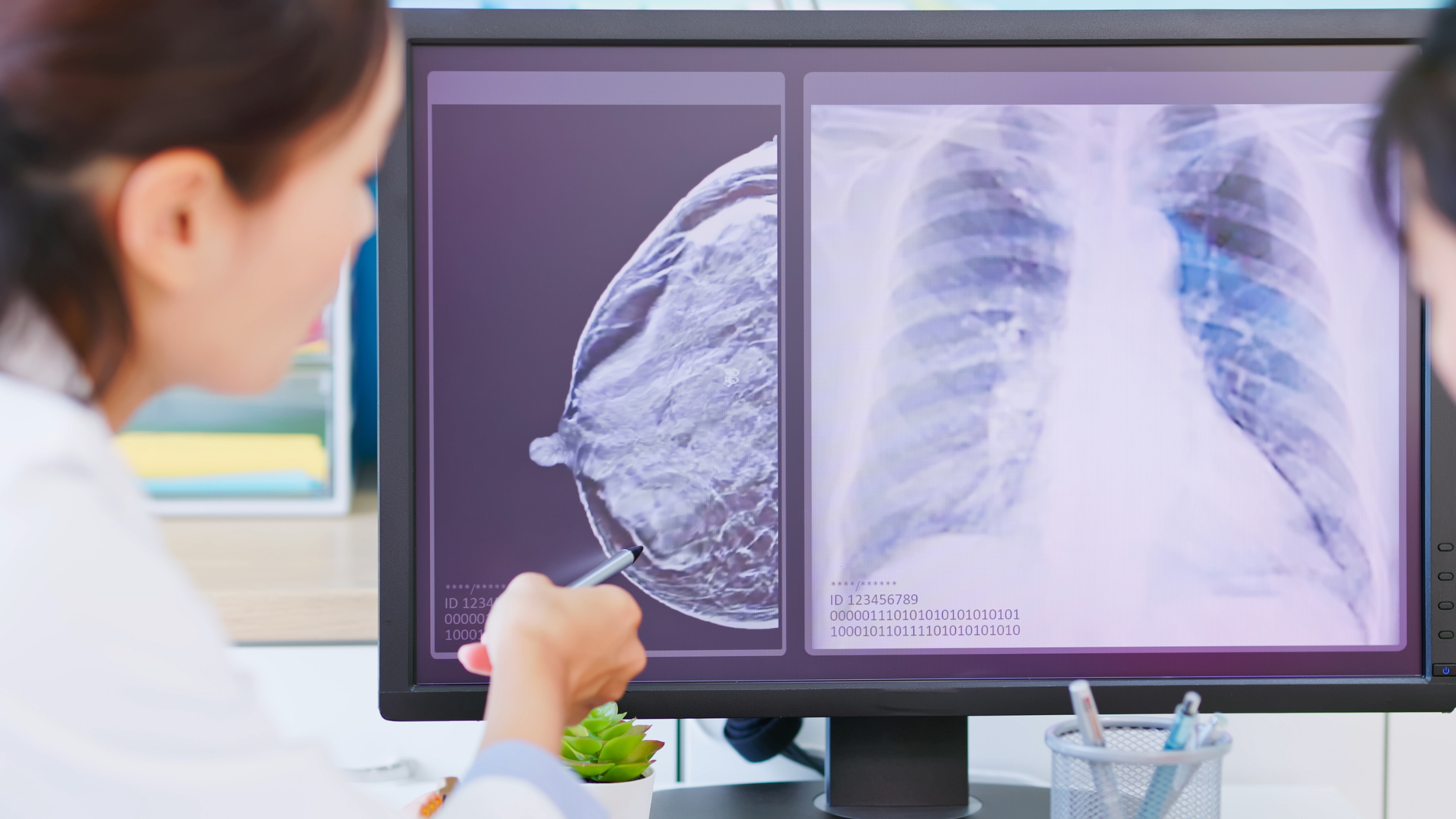 doctor points to a dark spot on a scan of someone's chest